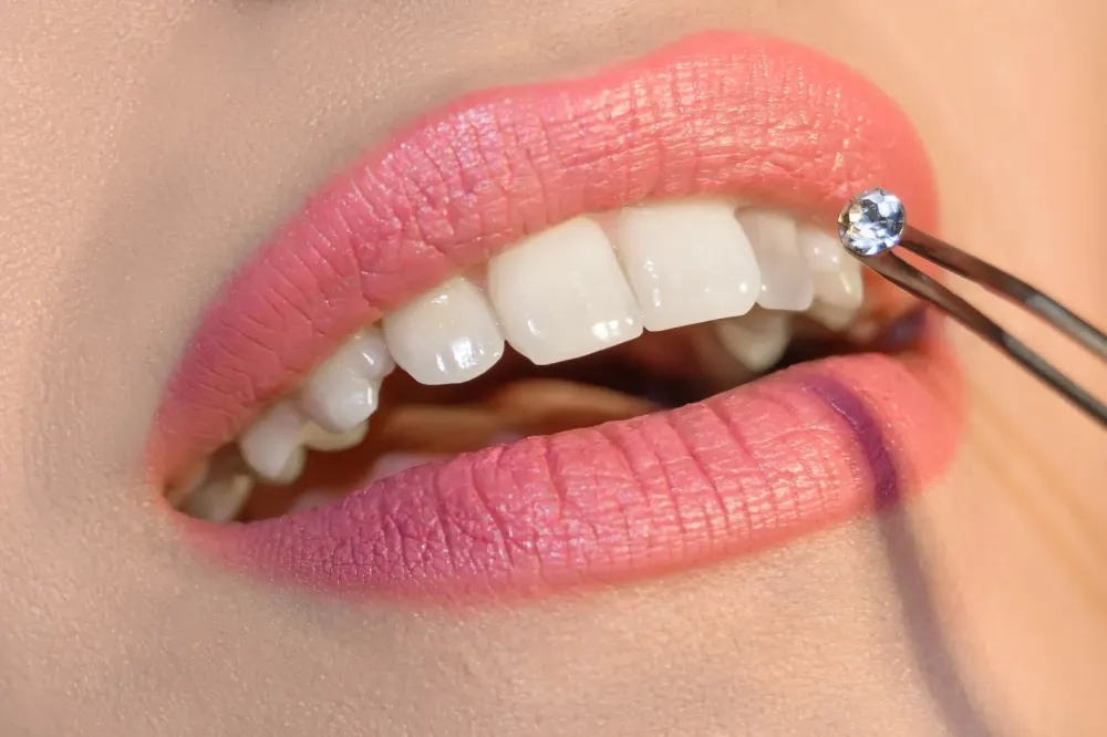 strass